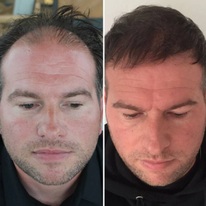 Thecair Cabello Abundante en solo 7 Días