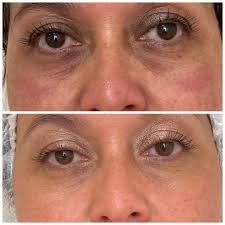 O´cheal Refresca y Reafirma tu mirada en 15 min.