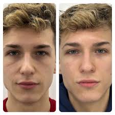 O´cheal Refresca y Reafirma tu mirada en 15 min.